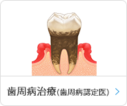 歯周病治療(歯周病認定医)