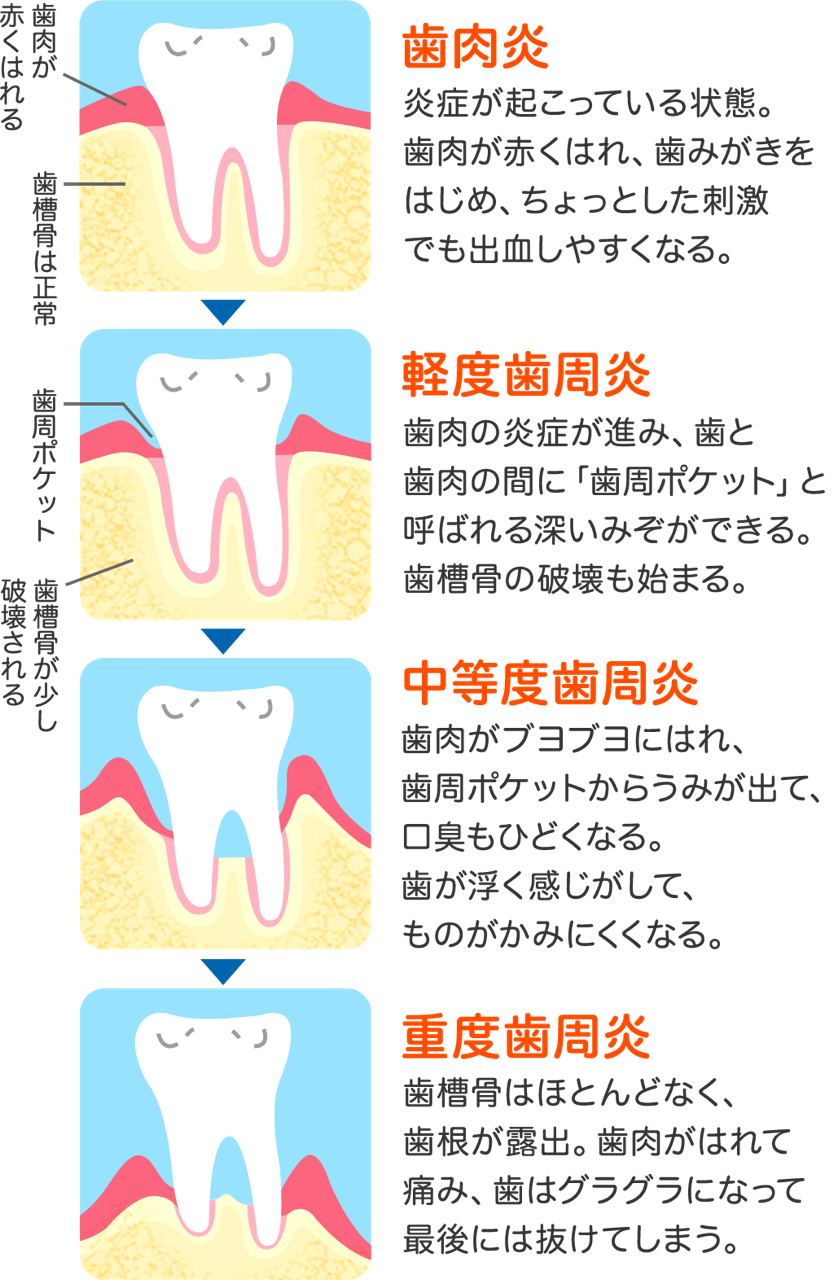 て 痛い 歯 が 浮い