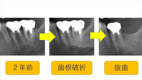 歯科健診