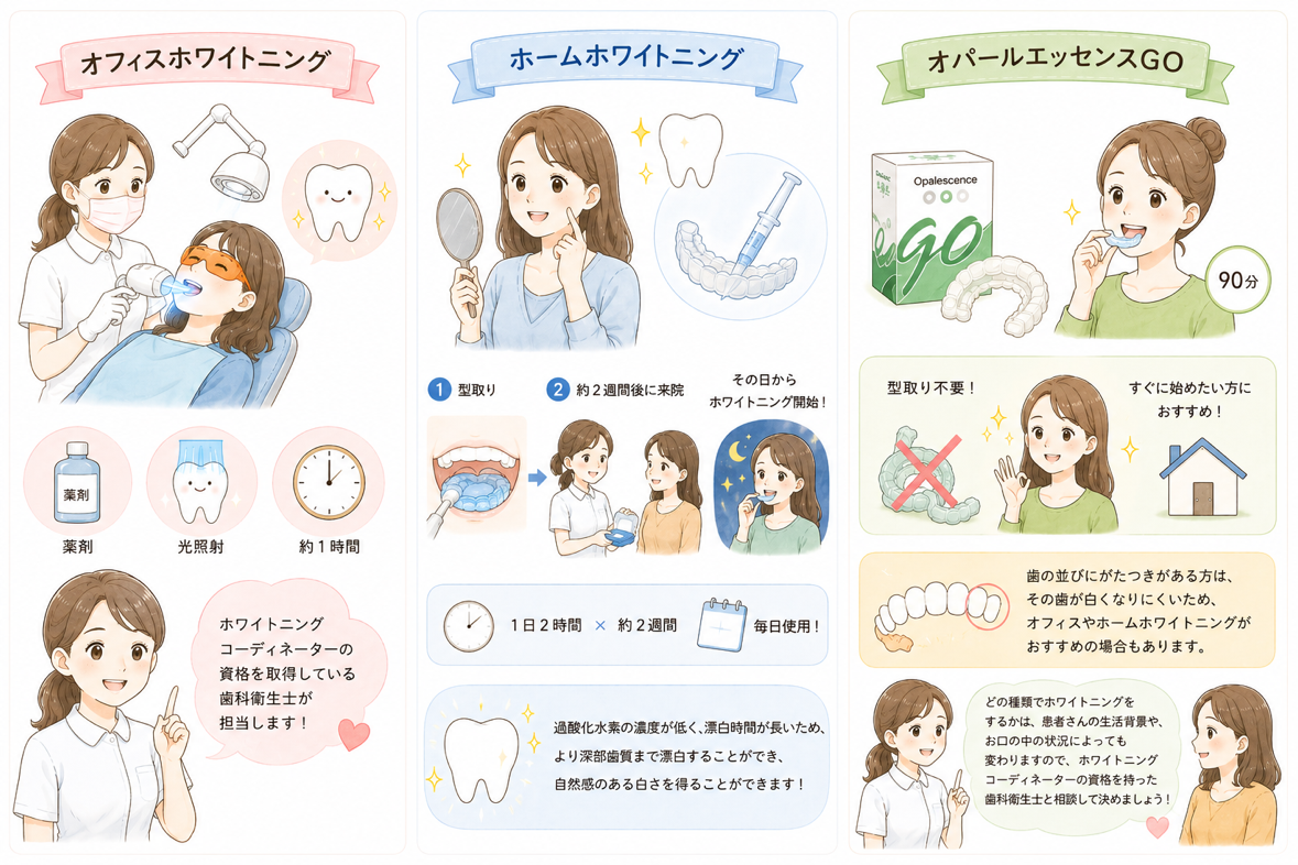 オフィスホワイトニング、ホームホワイトニング、オパールエッセンスGO