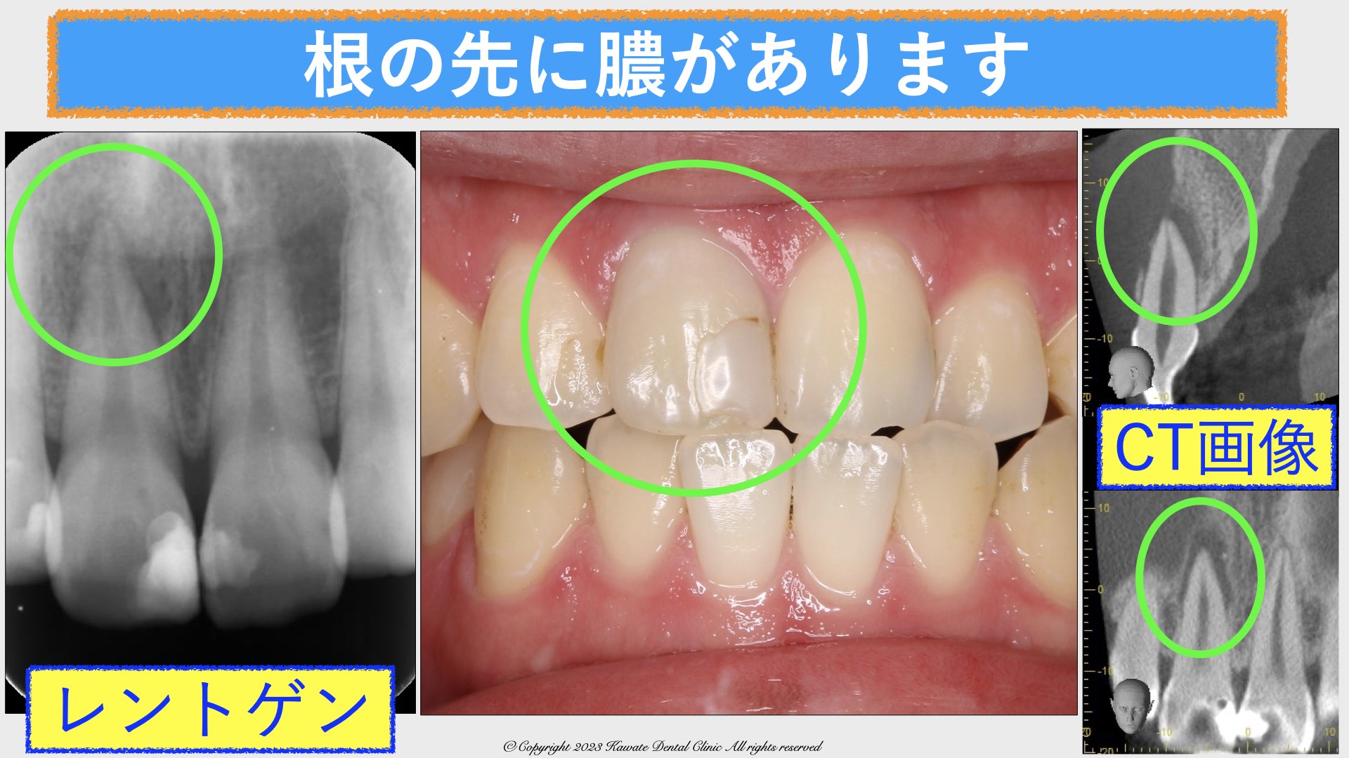 地域歯科イベント