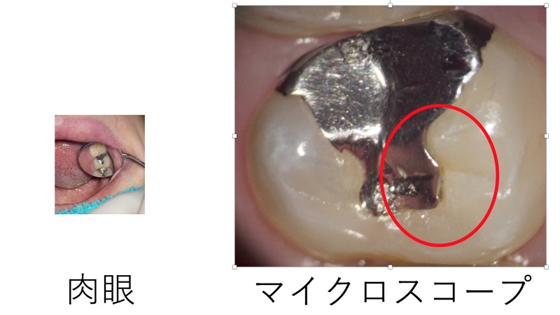 診査診断