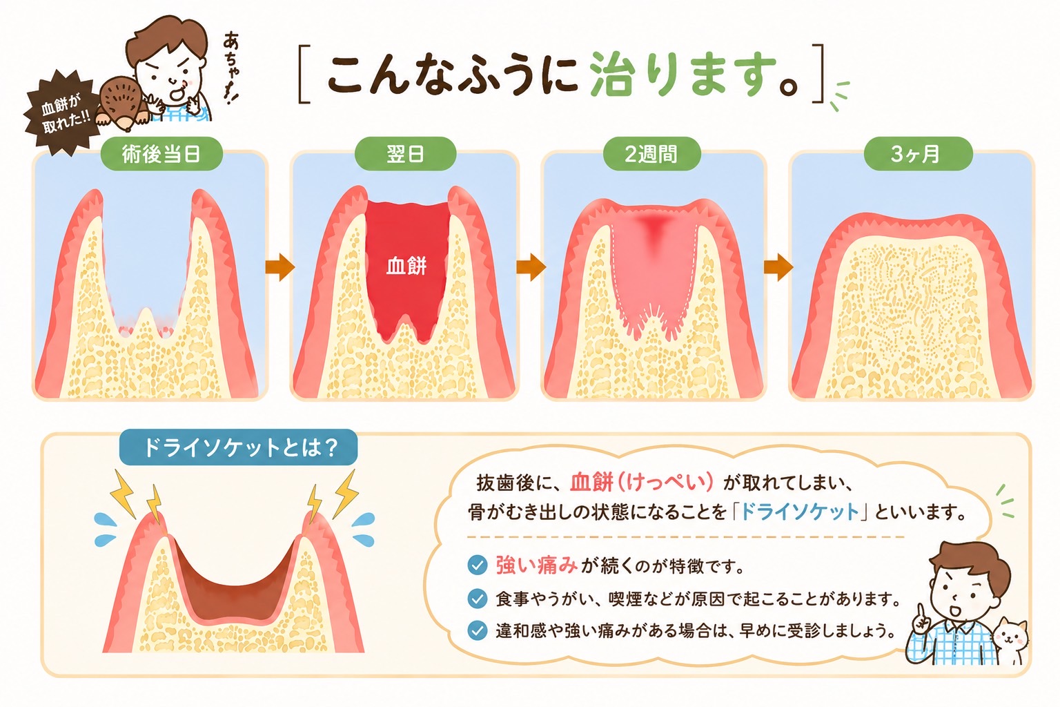 親知らずの治り方