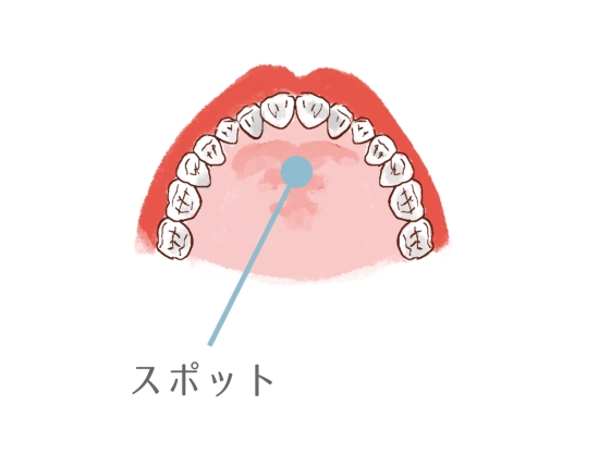 舌 の 正しい 位置